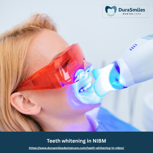 Teeth whitening in NIBM